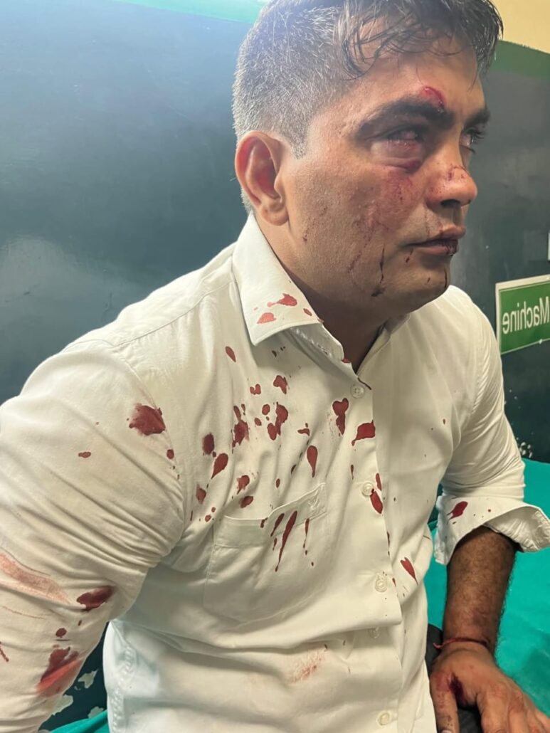 पंचकूला सेक्टर-1 कॉलेज के बीपीएड प्राध्यापक पर हमला